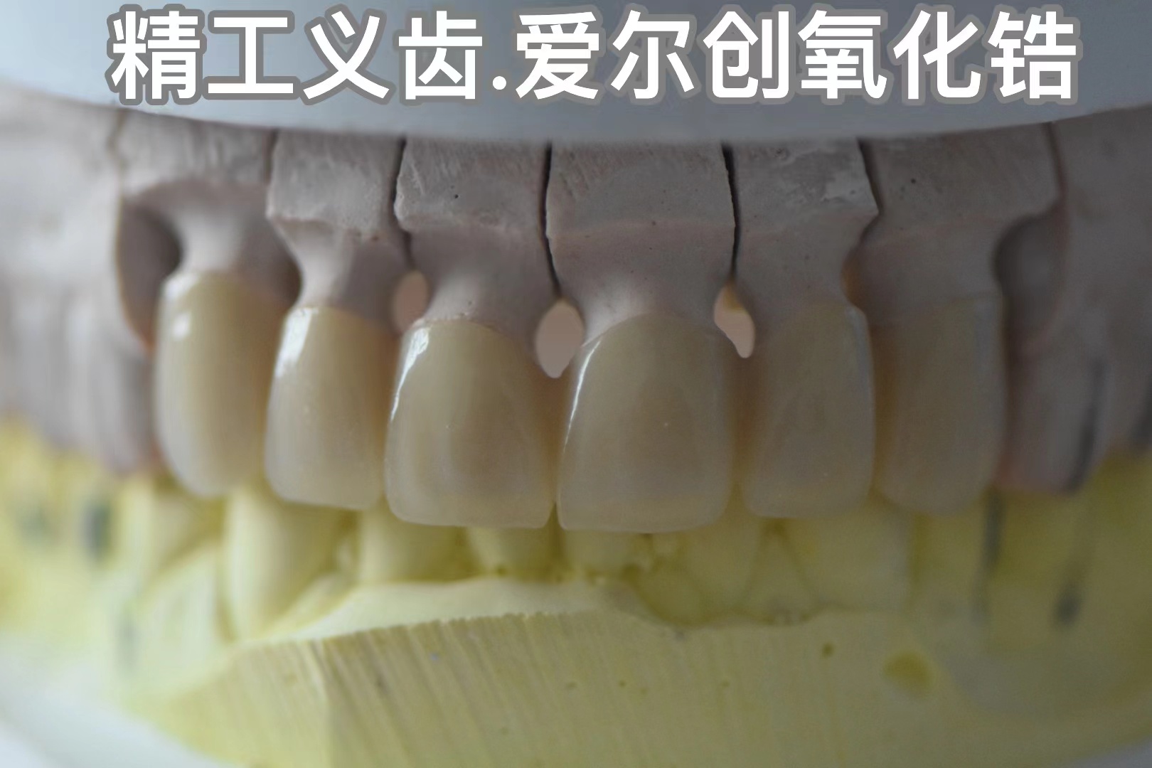 精工义齿-3M拉瓦氧化 锆